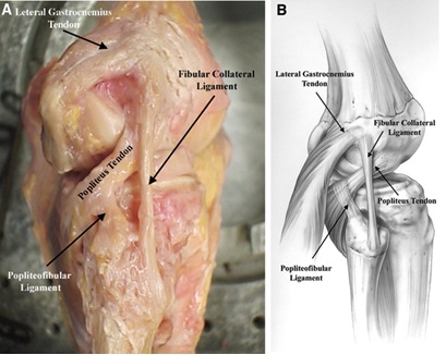 Popliteus tendon, Popliteofibular Ligament and FCL Anatomy