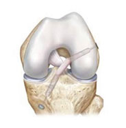 acl repair