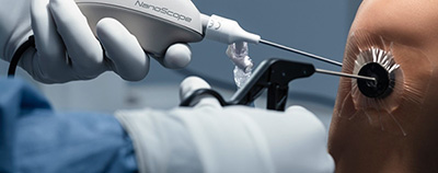 Nanoarthroscopy