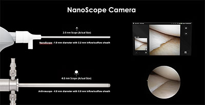 Nanoscopic Surgery at Mammoth Orthopedic Institute