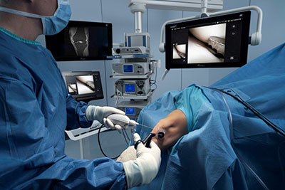 Nanoscopic Surgery at Mammoth Orthopedic Institute